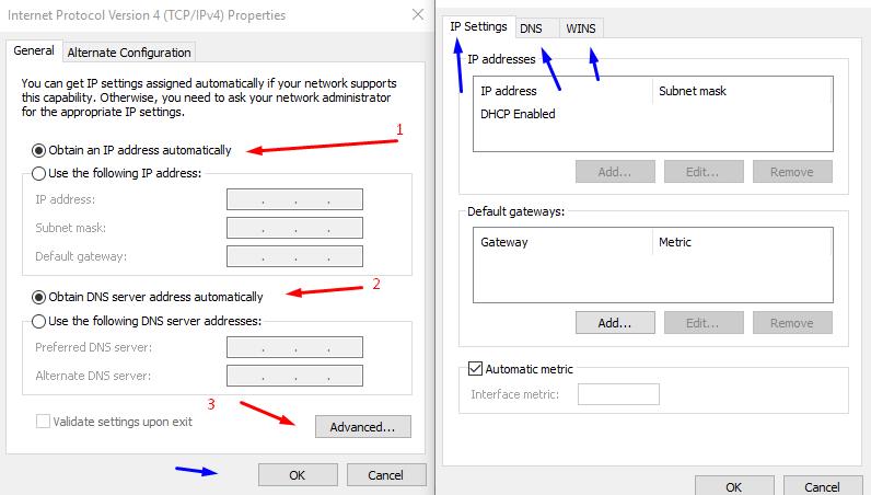 Set: obtain an IP address and DNS server address automaticaly
